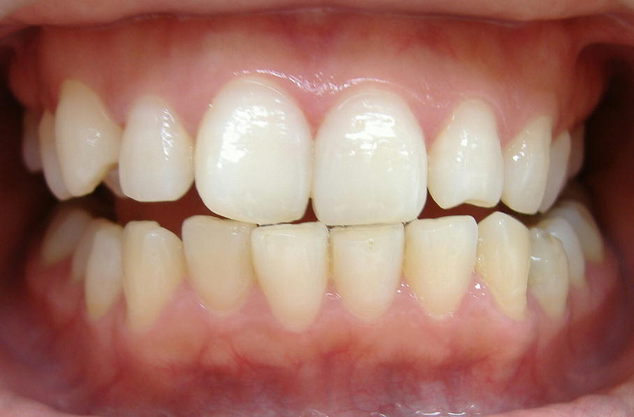 �U���E�E�W�F���P�{�I��