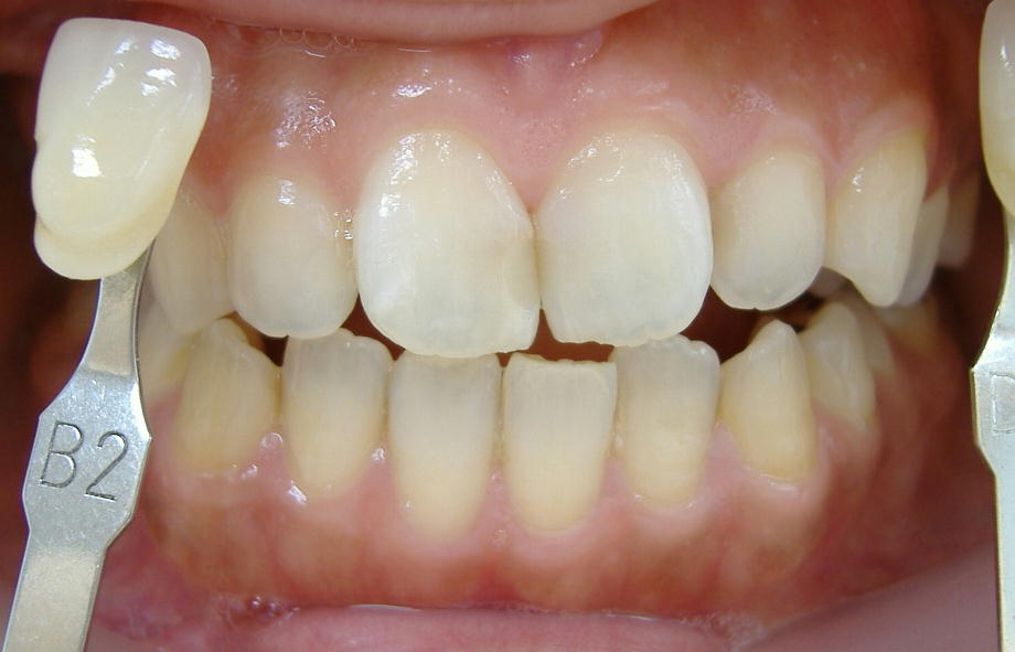 �U���E�E�W�F���P�{�I��