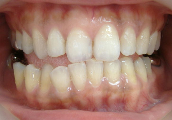 �P�Q���E�E�W�F���Q�{�ڏI��