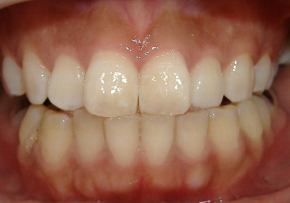 ��Ⴂ�ŁE�E�E�i1,5���Ԍ�j