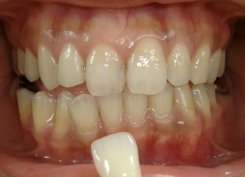 �U���E�E�W�F���P�{�ڏI��