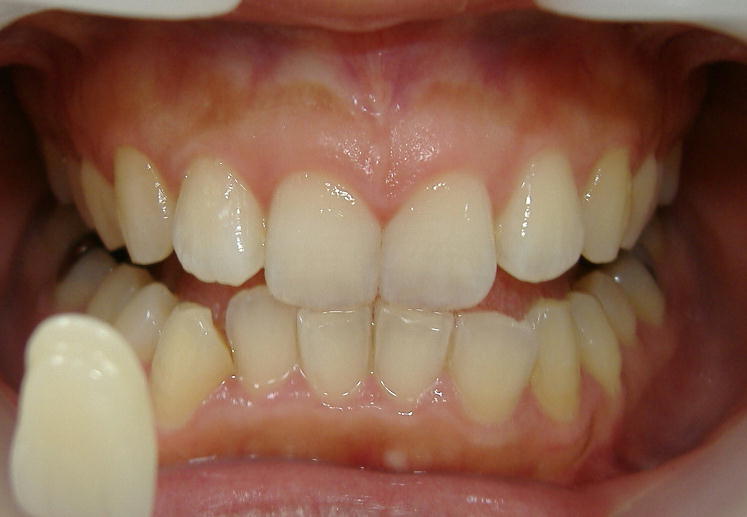 �U���E�E�W�F���P�{�I��