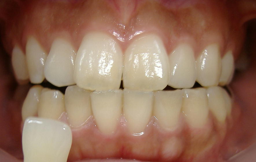 �U���E�E�W�F���P�{�I��