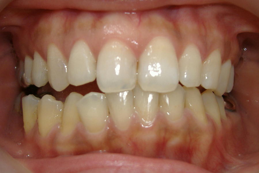 �P�W���E�E�W�F���R�{�I��