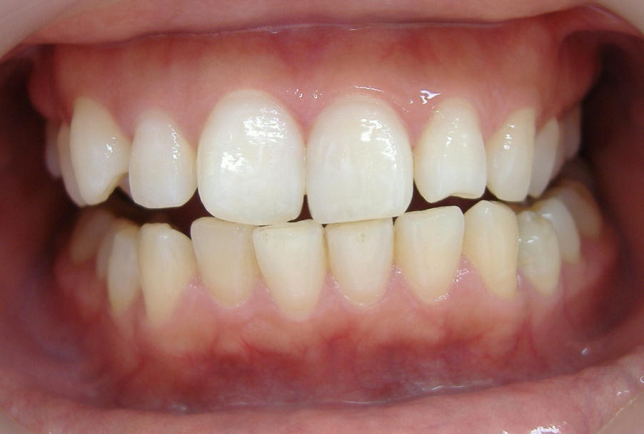 �P�Q���E�E�W�F���Q�{�I��