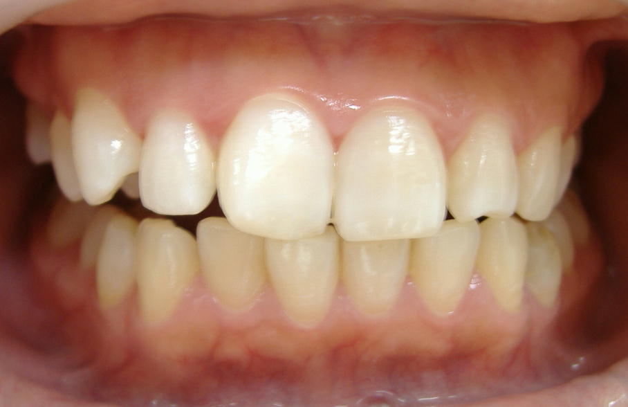 �P�W���E�E�W�F���R�{�I��