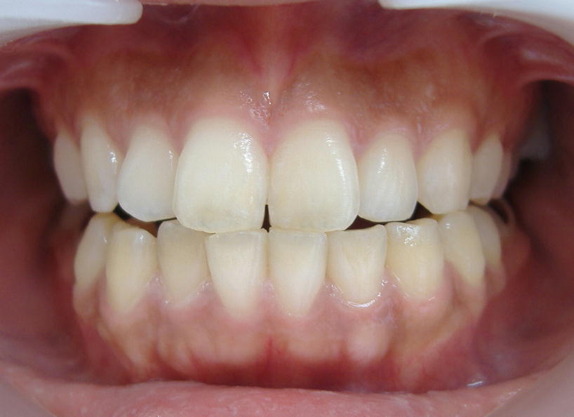 �P�Q���E�E�W�F���Q�{�I��