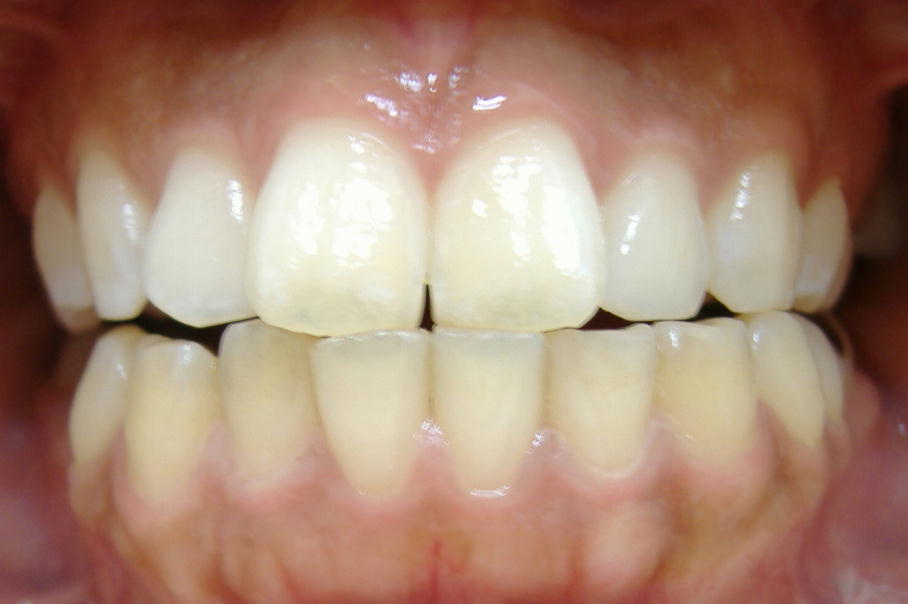 �P�W���E�E�W�F���R�{�I��