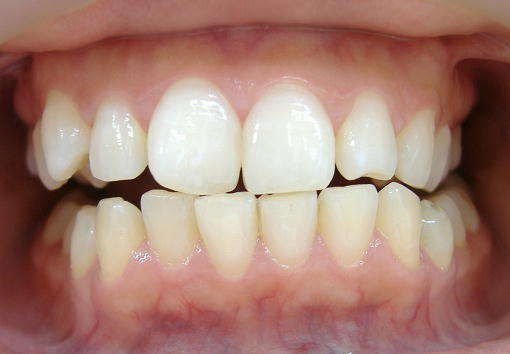 �Q�S���E�Efinish