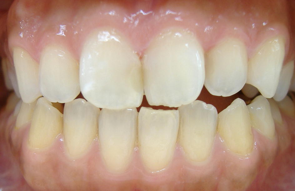 �P�Q���E�E�W�F���Q�{�I��