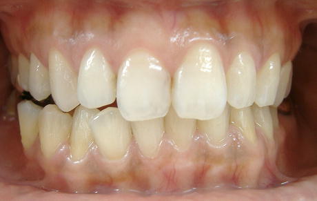 �Q�U���E�Efinish