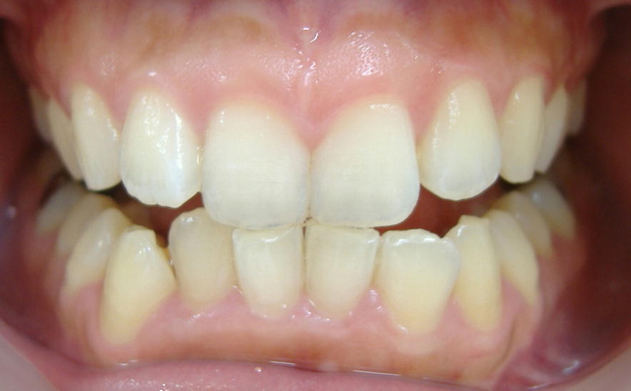 �P�W���E�E�W�F���R�{�I��